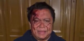 Grupo armado da golpiza en su casa a líder del Sindicato del ayuntamiento de Puebla