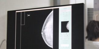 En promedio mueren 10 mujeres al mes por cáncer de mama en Puebla