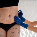 La cirugía de frente, cara y cuello o lift facial es ideal para lograr el rejuvenecimiento facial que deseas
